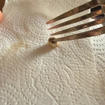 Tarım Ve Orman Bakanlığı Ekmekten Sigara İzmariti Çıktı: Sağlığımız Tehlikede!