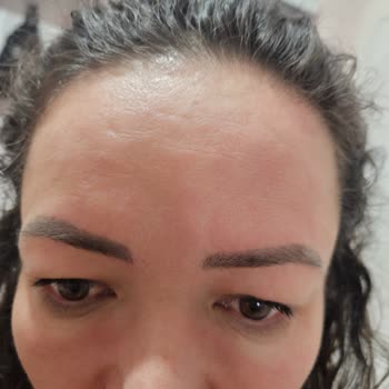 Dermatoloji Doktorunun Sert Tavrı Ve Beyaz Kod Uygulamasıyla Yaşadığım Psikolojik Yıpranma