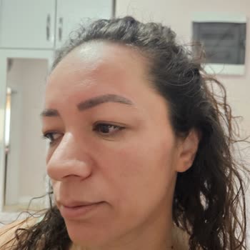 Dermatoloji Doktorunun Sert Tavrı Ve Beyaz Kod Uygulamasıyla Yaşadığım Psikolojik Yıpranma