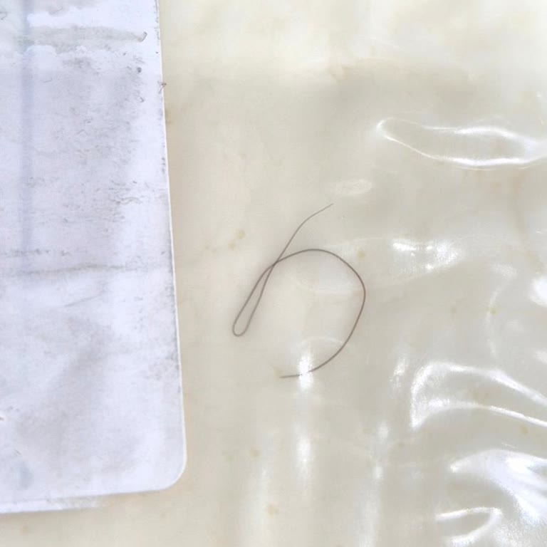 Peynirde Kıl Çıktı İade Süreci Gecikti Mağduriyet Yaşıyorum