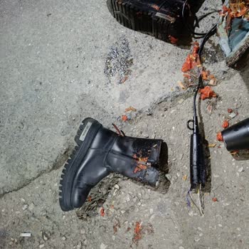 Servis Sürücüsünün İhmali Sonucu Valizim Zarar Gördü Ve Eşyalarım Kayboldu