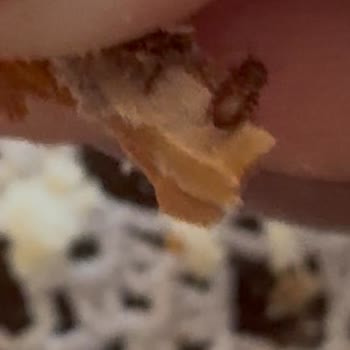 Aldığım Bademlerin İçinden Kurt Çıktı, Hijyen Sorunu Yaşadım