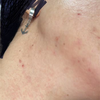 Aldığım Kozmetik Ürün Cildimde Alerjik Reaksiyona Sebep Oldu, Ücret İadesi Talep Ediyorum