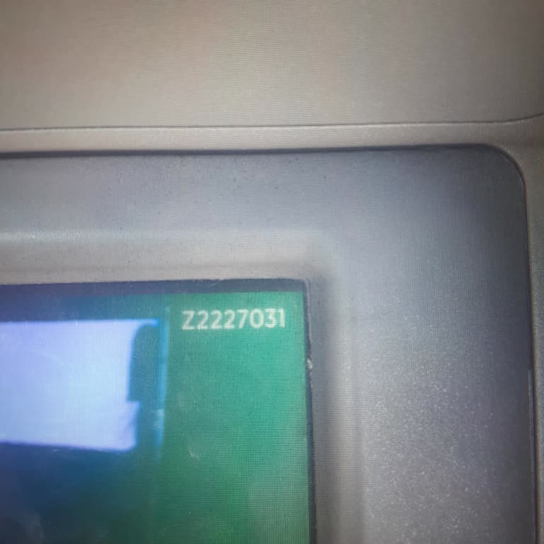 ATM'de Yutulan 4000 TL Ve Çözümsüzlük Mağduriyeti