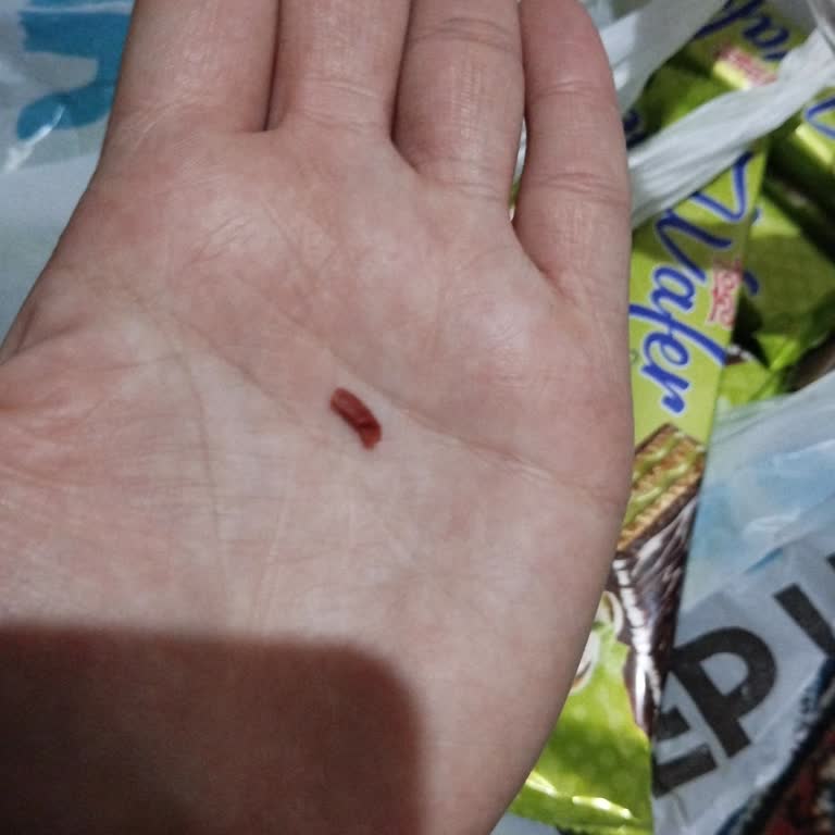 Aldığım Çikolatadan Yabancı Madde Çıktı, Sağlığım Ve Güvenim Tehlikede