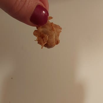 Yanlış Ve Kalitesiz Ürün Gönderimi Sonrası Yetersiz Çözüm