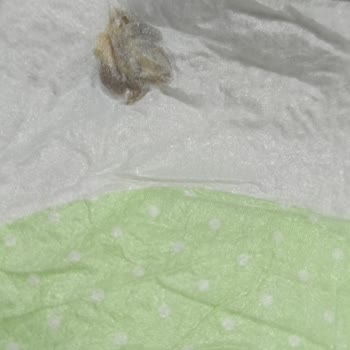 Bebek Bezinde Yabancı Cisim Şoku: Sağlık Riski Ve Güven Kaybı