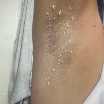 Nivea Black&White Stick Koltuk Altında Topaklanma Ve Dökülme Sorunu Yaşatıyor