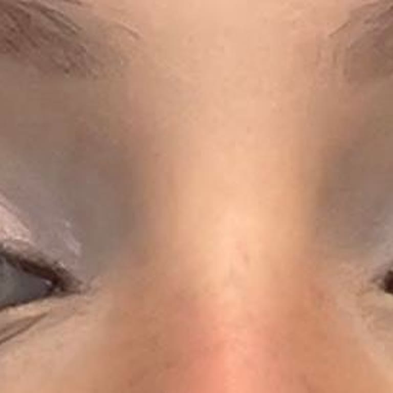 Kirpik Uygulaması Şikayeti ve Telafi Talebi