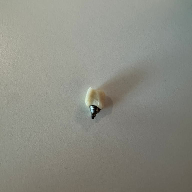 Garanti Kapsamındaki İmplantım Yemek Yerken Kırıldı