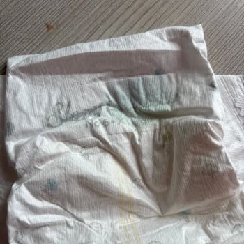 Sleepy Bio Natural Bebek Bezinde Yabancı Madde Ve Yetersiz Çözüm