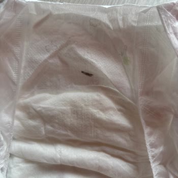 Sleepy Bio Natural Bebek Bezinde Yabancı Madde Ve Yetersiz Çözüm