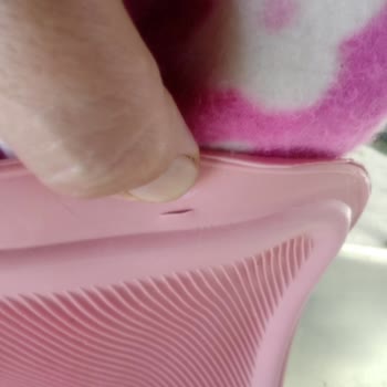 Sıcak Su Torbası Delindi, Yanık Ve Mağduriyet Yaşadım; Amazon'dan Yetersiz Destek