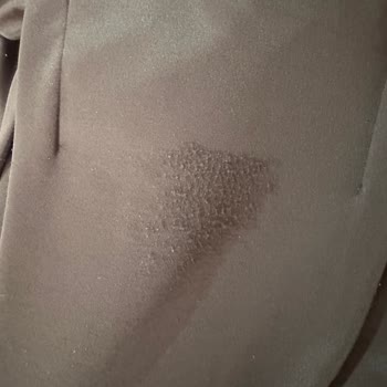 Nueny Prive Üründe Tüylenme Sorunu