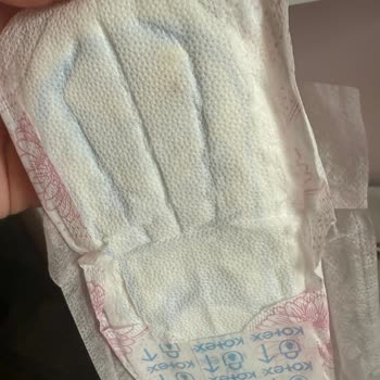 A101den Alınan Kotex Pedde Leke Çıktı Fişim Yok Para İadesi İstiyorum
