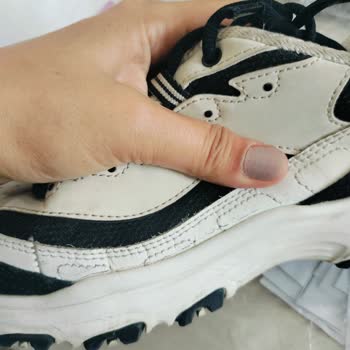 Skechers Ayakkabı 6 Ayda Parçalandı, İki Kez Red Cevabı Aldım