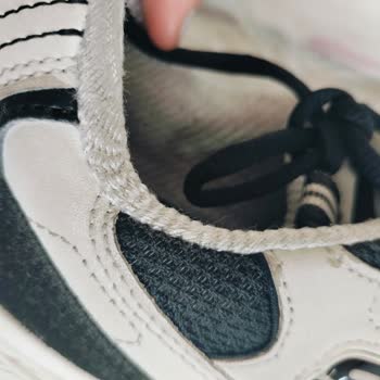 Skechers Ayakkabı 6 Ayda Parçalandı, İki Kez Red Cevabı Aldım