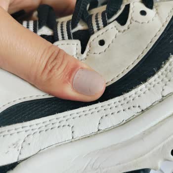 Skechers Ayakkabı 6 Ayda Parçalandı, İki Kez Red Cevabı Aldım