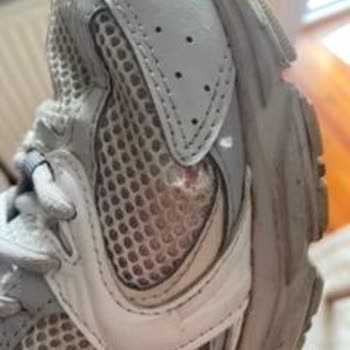 Kısa Sürede File Sökülmesi Ve İade Talebimin Reddedilmesi