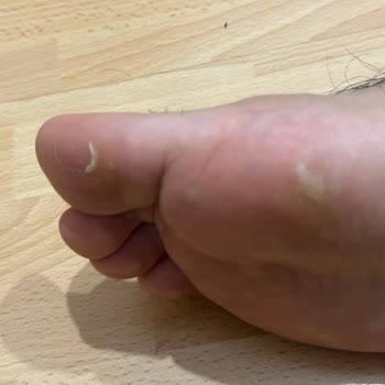 Mizuno Kramponunda Ciddi Rahatsızlık Ve Yetersiz Müşteri Hizmeti