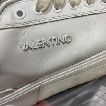 Aynı Ayakkabıda Tekrarlayan Sorunlar Ve Yetersiz Destek