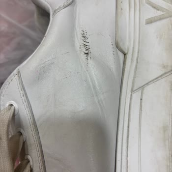 Aynı Ayakkabıda Tekrarlayan Sorunlar Ve Yetersiz Destek