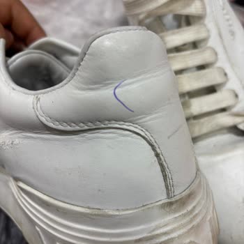 Aynı Ayakkabıda Tekrarlayan Sorunlar Ve Yetersiz Destek