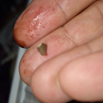 Dondurmanın İçinden Taş Çıktı Çocuklarımızın Sağlığı Tehlikeye Girdi