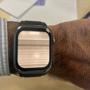 Huawei Watch D2 Ekran Arızası Kısa Sürede Kullanılamaz Hale Geldi