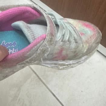Beymen 2 Ayda Deforme Olan Skechers Ayakkabı İçin Değişim Veya İade Talebi