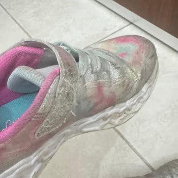 Beymen 2 Ayda Deforme Olan Skechers Ayakkabı İçin Değişim Veya İade Talebi