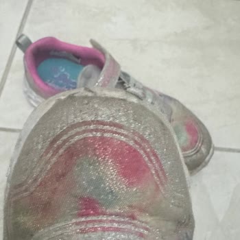 Beymen 2 Ayda Deforme Olan Skechers Ayakkabı İçin Değişim Veya İade Talebi