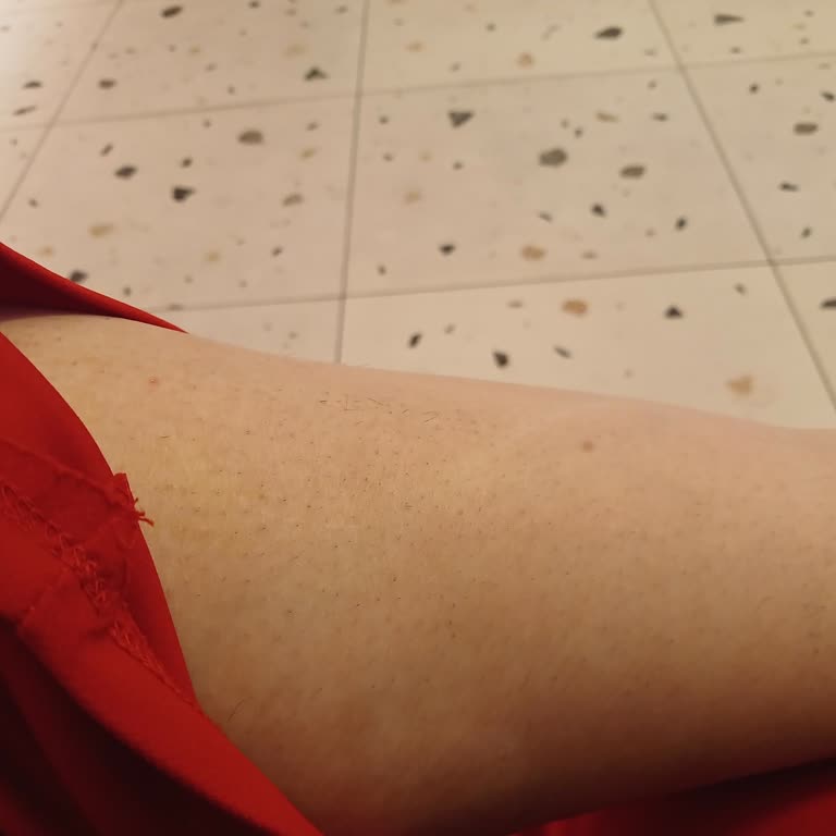 Nez Demir Lazer Epilasyon İşlemi Reddedildi, Ücret İadesi Talep Ediyorum