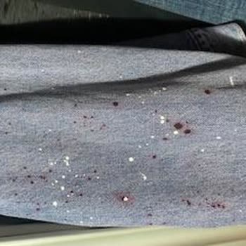 Levis Ceket Renk Attı, İade Talebim Reddedildi!