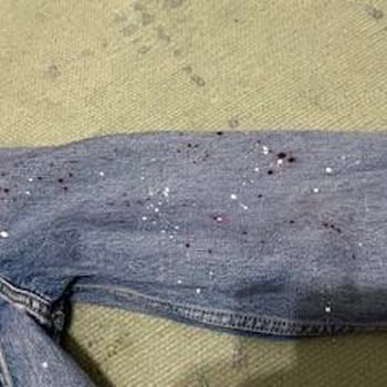 Levis Ceket Renk Attı, İade Talebim Reddedildi!