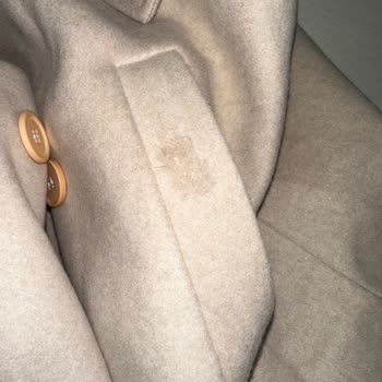 Kusurlu Gelen Ceket İçin Canlı Destek Sorunu Ve Değişim Talebi