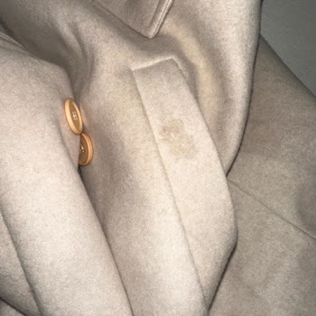 Kusurlu Gelen Ceket İçin Canlı Destek Sorunu Ve Değişim Talebi