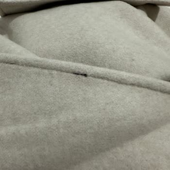 Kusurlu Gelen Ceket İçin Canlı Destek Sorunu Ve Değişim Talebi