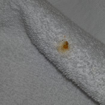 Otto Hotels Böcekler Ve Ciddi Hijyen Eksiklikleri Nedeniyle Büyük Bir Mağduriyet Yaşadım