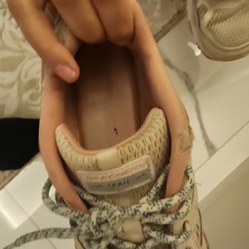 Kısa Sürede Deforme Olan Ayakkabıya İade Veya Değişim Talebi