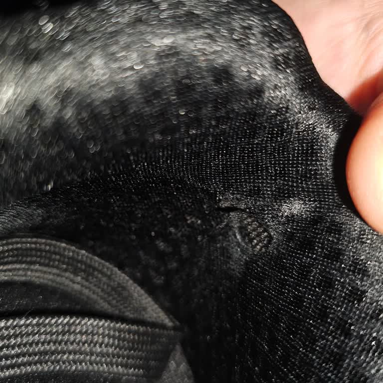 Skechers Kısa Sürede Deforme Olan Ayakkabıma Değişim Talebim Reddedildi!