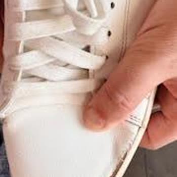 Kısa Sürede Açılan Ayakkabıya Çözüm Sunulmadı, İade Talebim Karşılanmadı