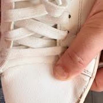 Kısa Sürede Açılan Ayakkabıya Çözüm Sunulmadı, İade Talebim Karşılanmadı