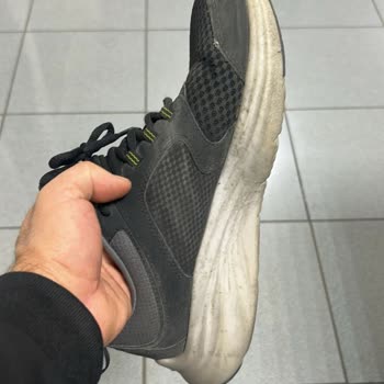 Skechers Ayakkabıda Tekrarlayan Anorak Deformasyonu Ve Garanti Sorunu