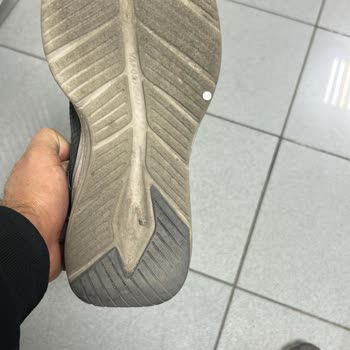 Skechers Ayakkabıda Tekrarlayan Anorak Deformasyonu Ve Garanti Sorunu