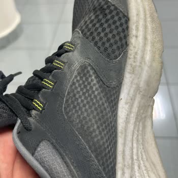 Skechers Ayakkabıda Tekrarlayan Anorak Deformasyonu Ve Garanti Sorunu