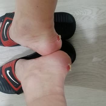 Kullanılamaz Duruma Gelen Bot İçin İade Talebime Olumsuz Yaklaşım Ve Yetersiz Müşteri Hizmetleri