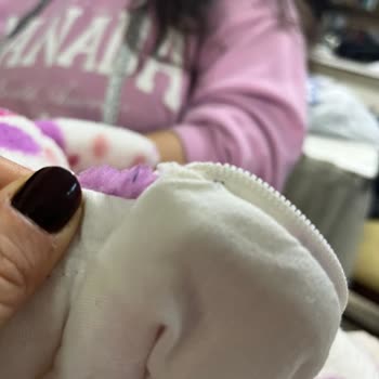 Bebek Ceketi Fermuarı Boynunu Kesti Kanama Oldu