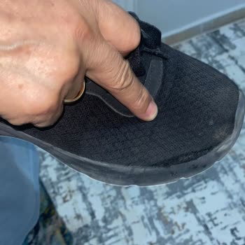 Skechers Online Mağazadan Alınan Ayakkabıda Erken Deformasyon ve Çözüm Eksikliği