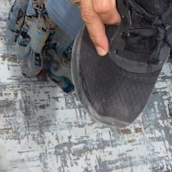 Skechers Online Mağazadan Alınan Ayakkabıda Erken Deformasyon ve Çözüm Eksikliği